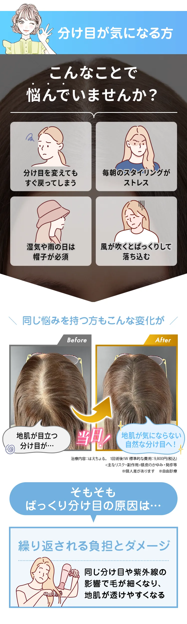 分け目の広がり