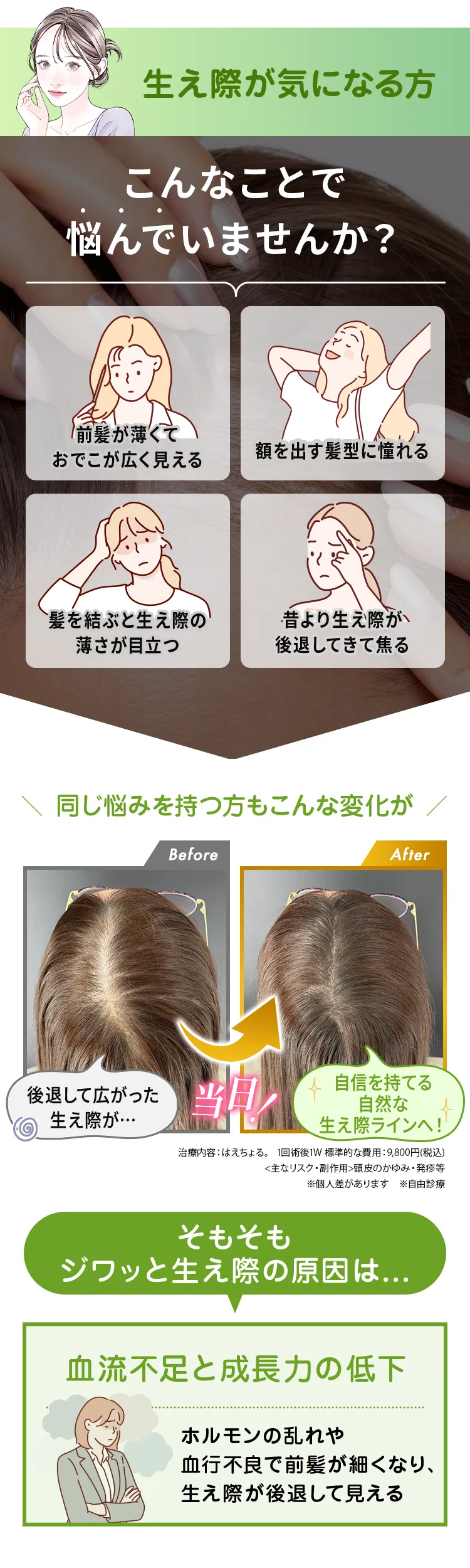 生え際の後退
